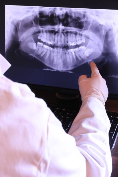 Best Emergency Treatment for Oral Infections in Delafield, WI