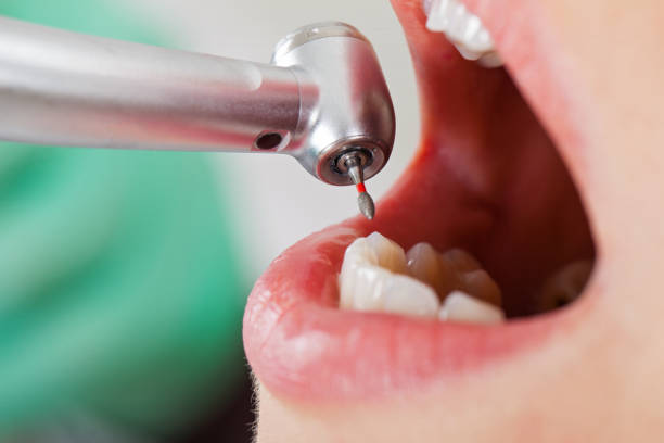 Best Broken or Chipped Tooth Repair in Delafield, WI
